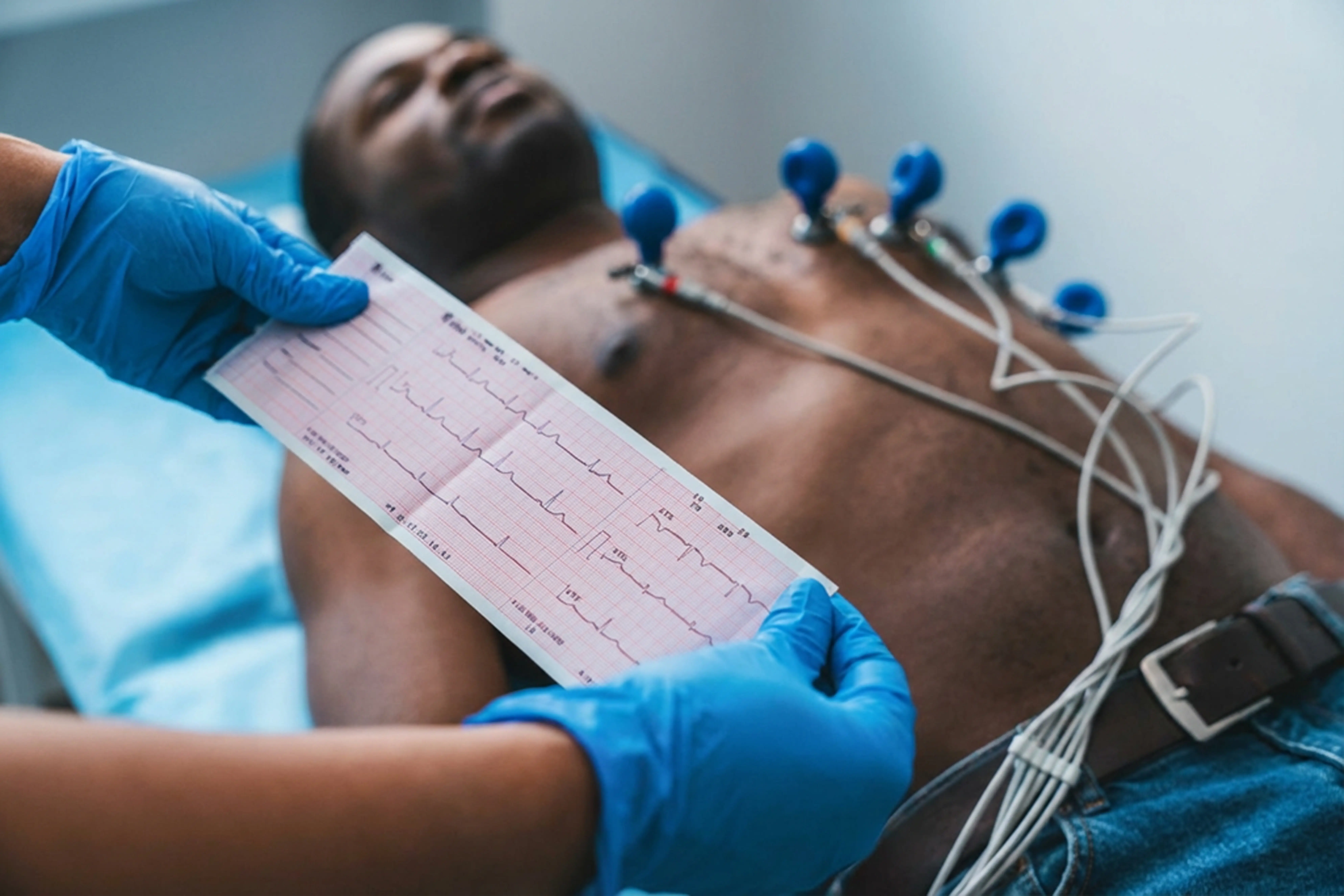 Electrocardiograma